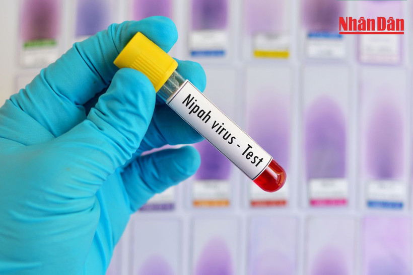 Chủ động phòng, chống bệnh do virus Nipah trong các cơ sở y tế